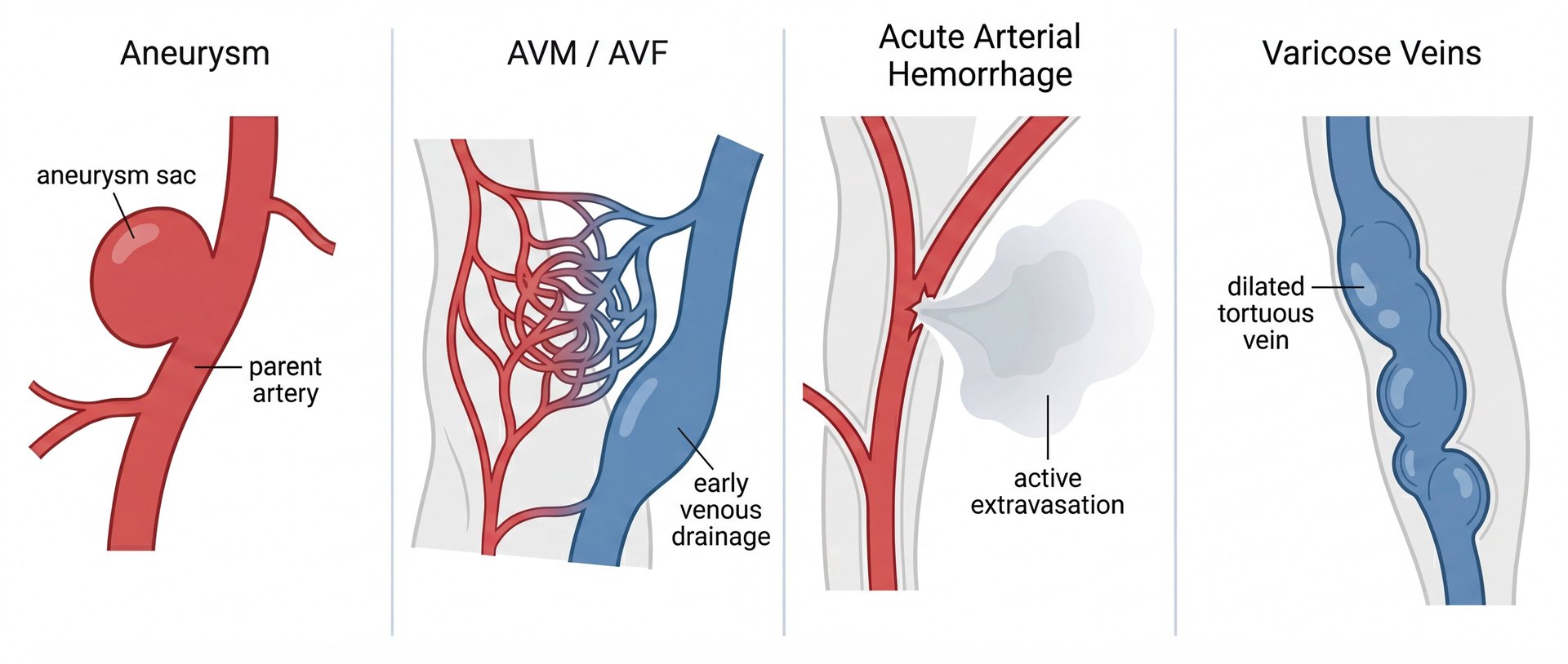 Expansible collagen sponge